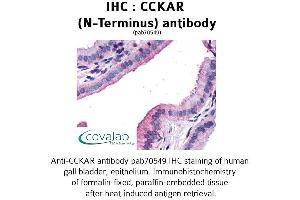 Image no. 1 for anti-Cholecystokinin A Receptor (CCKAR) (Extracellular Domain), (N-Term) antibody (ABIN1732733) (CCKAR anticorps  (Extracellular Domain, N-Term))