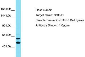 Host: Rabbit Target Name: SOGA1 Sample Type: OVCAR-3 Whole Cell lysates Antibody Dilution: 1. (SOGA1 anticorps  (C-Term))