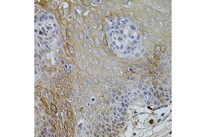 Immunohistochemistry of paraffin-embedded human esophagus using KCNJ3 antibody (ABIN6003556) at dilution of 1/100 (40x lens). (KCNJ3 anticorps)
