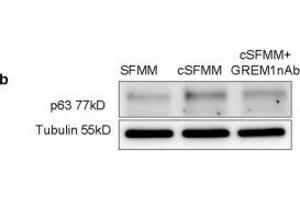 HEMF secreted factors increase epithelial basal cell p63 expression in 3D organotypic ALI culture.
