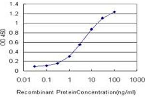 Detection limit for recombinant GST tagged RORB is approximately 0. (RORB anticorps  (AA 136-224))