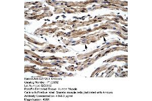 Human Muscle (GTF2E1 anticorps  (C-Term))