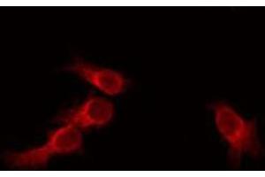 ABIN6275718 staining HeLa by IF/ICC. (RNF130 anticorps  (Internal Region))