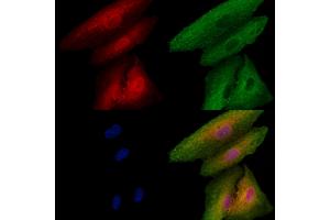 ABIN6256863 and ABIN6273491 staining  cells by IF/ICC. (MAPK13 anticorps  (C-Term))