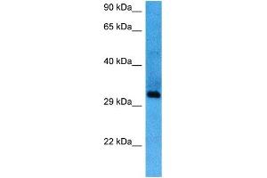 Host:  Mouse  Target Name:  SIX1  Sample Tissue:  Mouse Spleen  Antibody Dilution:  1ug/ml (SIX Homeobox 1 anticorps  (Middle Region))