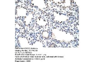 Rabbit Anti-CSDC2 Antibody  Paraffin Embedded Tissue: Human Lung Cellular Data: Alveolar cells Antibody Concentration: 4. (CSDC2 anticorps  (N-Term))