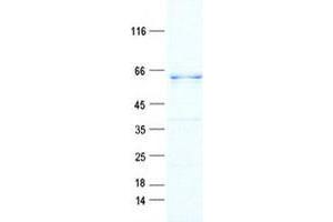 Validation with Western Blot