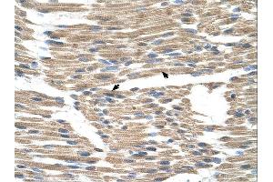 GPR177 antibody was used for immunohistochemistry at a concentration of 4-8 ug/ml. (GPR177/WLS anticorps  (N-Term))