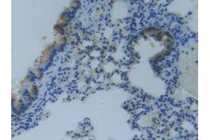 IHC-P analysis of Mouse Lung Tissue, with DAB staining.