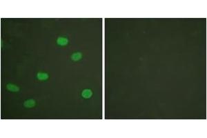 Immunofluorescence analysis of HeLa cells, using Lamin A/C (Phospho-Ser392) Antibody. (Lamin A/C anticorps  (pSer392))