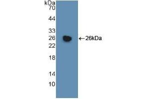 Western blot analysis of recombinant Human GSTm1. (GSTM1 anticorps  (AA 1-218))