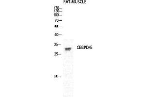 Western Blot (WB) analysis of Rat Muscle cells using C/EBP delta/epsilon Polyclonal Antibody. (C/EBP delta/epsilon (C-Term) anticorps)