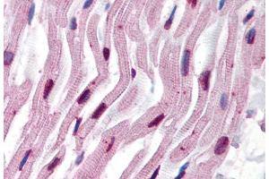 Immunohistochemistry staining of human heart (paraffin sections) using anti-alpha tubulin (TU-16).