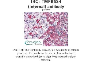 Image no. 1 for anti-Transmembrane Protease, serine 4 (TMPRSS4) (Internal Region) antibody (ABIN1740175) (TMPRSS4 anticorps  (Internal Region))