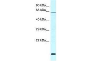 Image no. 1 for anti-DDB1 and CUL4 Associated Factor 11 (DCAF11) (AA 335-384) antibody (ABIN6747763)