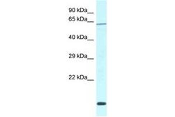 DCAF11 Antikörper  (AA 335-384)