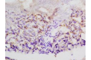 Formalin-fixed and paraffin embedded rat testis labeled with Anti-ASZ1 Polyclonal Antibody, Unconjugated  at 1:200 followed by conjugation to the secondary antibody and DAB staining