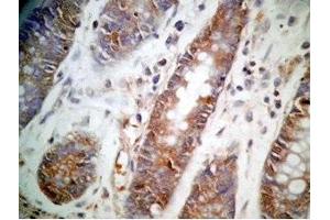 Human colon tissue was stained by Rabbit Anti-GLP-1 (12-24) (Human) Antibody (GLP-1 anticorps  (AA 12-24))