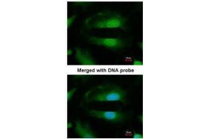 ICC/IF Image Immunofluorescence analysis of paraformaldehyde-fixed HeLa, using Selenophosphate synthetase 1, antibody at 1:200 dilution. (SEPHS1 anticorps)