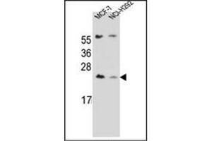 Western blot analysis of LIN7C Antibdy (C-term) in MCF-7, NCI-H292 cell line lysates (35ug/lane). (LIN7C anticorps  (C-Term))