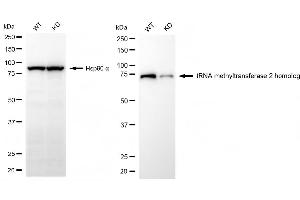 Western blotting analysis using tRNA methyltransferase 2 homolog antibody (ABIN7800983). (Recombinant TRNA Methyltransferase 2 Homolog anticorps)