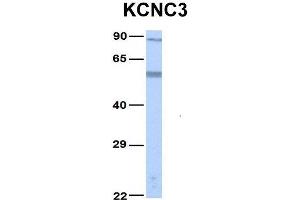 Host:  Rabbit  Target Name:  KCNC3  Sample Type:  Human Fetal Lung  Antibody Dilution:  1. (KCNC3 anticorps  (Middle Region))