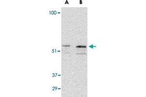 Western blot analysis of PAK2 in Jurkat lysate with PAK2 polyclonal antibody  at (A) 0.
