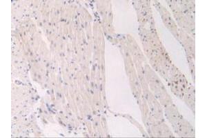 IHC-P analysis of Mouse Heart Tissue, with DAB staining. (FLT1 anticorps  (AA 27-329))