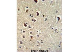 Immunohistochemistry (IHC) image for anti-Kruppel-Like Factor 11 (KLF11) antibody (ABIN3002716)