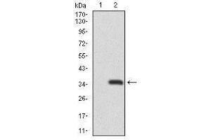Image no. 2 for anti-Recombination Activating Gene 1 (RAG1) antibody (ABIN1491682) (RAG1 anticorps)