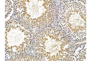 ABIN6257415 and ABIN6275226 at 1/100 staining rat testis tissue by IHC-P. (PGRMC2 anticorps  (C-Term))
