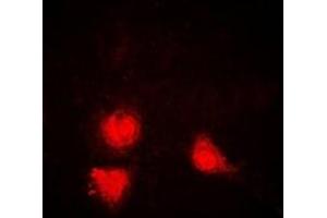 Immunofluorescent analysis of SIRT1 staining in Jurkat cells.