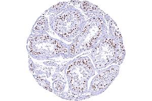 Testis with gradual decrease of 53BP1 staining with maturation of germ cells. (Recombinant TP53BP1 anticorps  (C-Term))