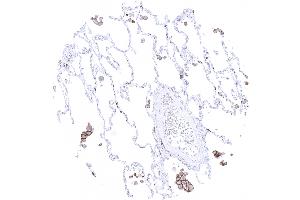 Alveolar macrophages show strong TIM 3 immunostaining (Recombinant TIM3 anticorps)