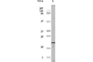 Western blot analysis using 4E-BP1 antibody against truncated 4E-BP1 recombinant protein (1). (eIF4EBP1 anticorps)