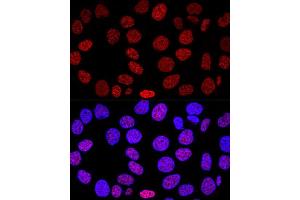 Confocal immunofluorescence analysis of HeLa cells using Histone H2AX Polyclonal Antibody (ABIN6134695, ABIN6141564, ABIN6141567 and ABIN6219268) at dilution of 1:200. (Histone H2A anticorps)