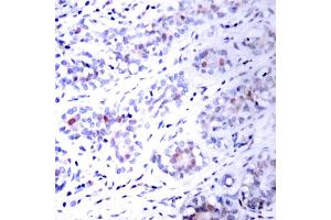 Image no. 2 for anti-Signal Transducer and Activator of Transcription 3 (Acute-Phase Response Factor) (STAT3) antibody (ABIN271827)