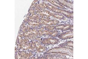 Immunohistochemical staining of human stomach with WDR5B polyclonal antibody , upper shows moderate cytoplasmic positivity in glandular cells at 1:10-1:20 dilution. (WDR5B anticorps)