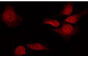 ABIN6277169 staining RAW264. (Presenilin 1 anticorps  (Internal Region))