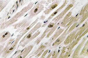Immunohistochemistry (IHC) analyzes of PAKγ antibody in paraffin-embedded human heart tissue. (PAK2 anticorps)