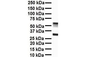 WB Suggested Anti-ZFX antibody Titration: 1 ug/mL Sample Type: Human liver (ZFX anticorps  (C-Term))