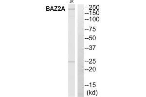 Western blot analysis of extracts from Jurkat cells, using BAZ2A antibody. (BAZ2A anticorps  (Internal Region))