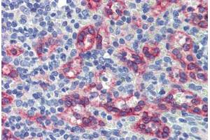 Spleen, Human: Formalin-Fixed, Paraffin-Embedded (FFPE) (ZNF71 anticorps  (C-Term))