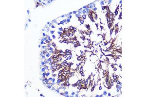Immunohistochemistry of paraffin-embedded Rat testis using LETMD1 Rabbit pAb (ABIN3023040, ABIN3023041, ABIN3023042, ABIN1513151 and ABIN6219360) at dilution of 1:100 (40x lens).