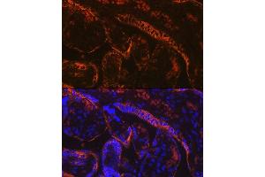 Immunofluorescence analysis of human placenta using Aromatase (CYP19) Rabbit mAb (2238) at dilution of 1:100 (40x lens). (Aromatase anticorps)