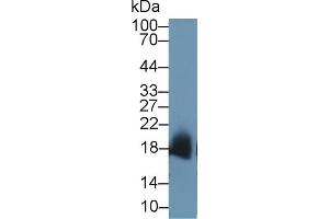 Detection of SOD1 in Mouse Uterus lysate using Polyclonal Antibody to Superoxide Dismutase 1 (SOD1) (SOD1 anticorps  (AA 2-154))