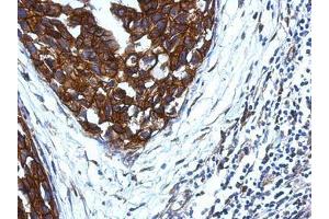 Image no. 1 for anti-Killer Cell Immunoglobulin-Like Receptor, Two Domains, Short Cytoplasmic Tail, 4 (KIR2DS4) (AA 1-294) antibody (ABIN1499052)