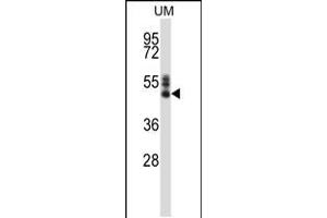 Western blot analysis in human uterine tomer tissue lysates (35ug/lane).