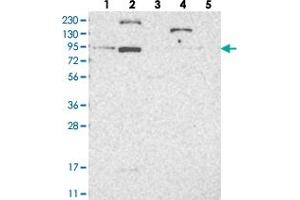Western blot analysis of Lane 1: RT-4, Lane 2: U-251 MG, Lane 3: Human Plasma, Lane 4: Liver, Lane 5: Tonsil with LCA5 polyclonal antibody . (LCA5 anticorps)