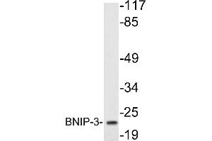 Western blot (WB) analysis of BNIP-3 antibody in extracts from K562cells. (BNIP3 anticorps)